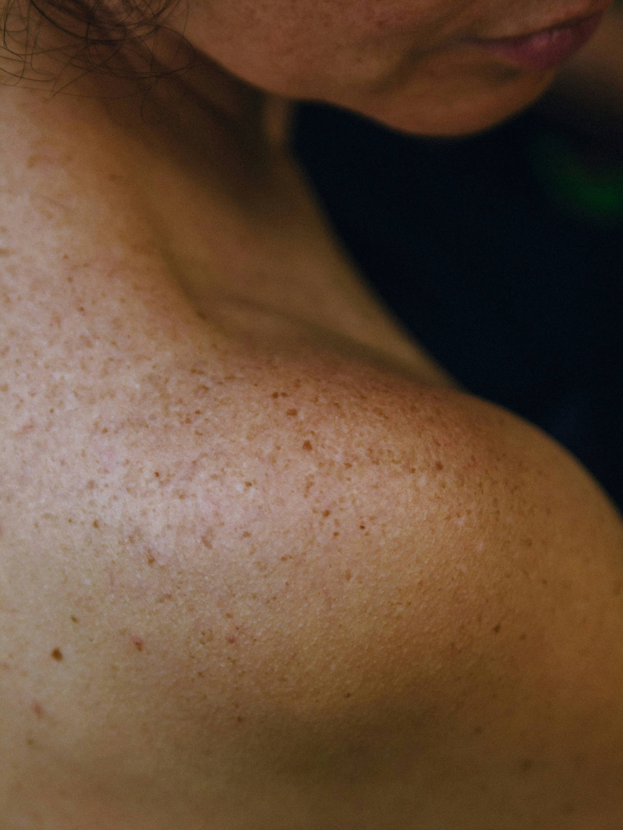 The Skin
